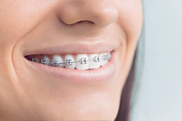Best Full Mouth Reconstruction  in Southeast Arcadia, FL
